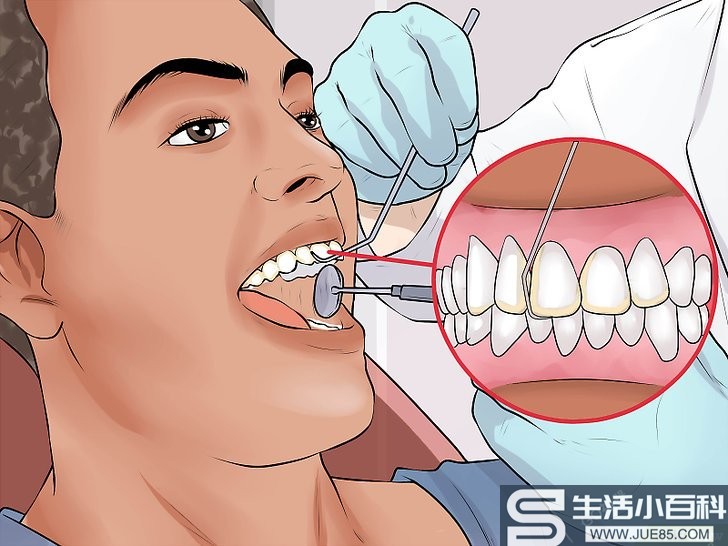 如何打磨假牙: 13 步骤