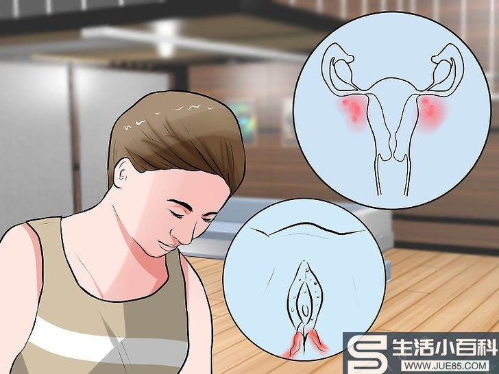 如何识别外阴癌的症状: 8 步骤
