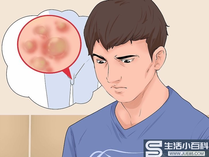 3种方法来治愈男性尖锐湿疣