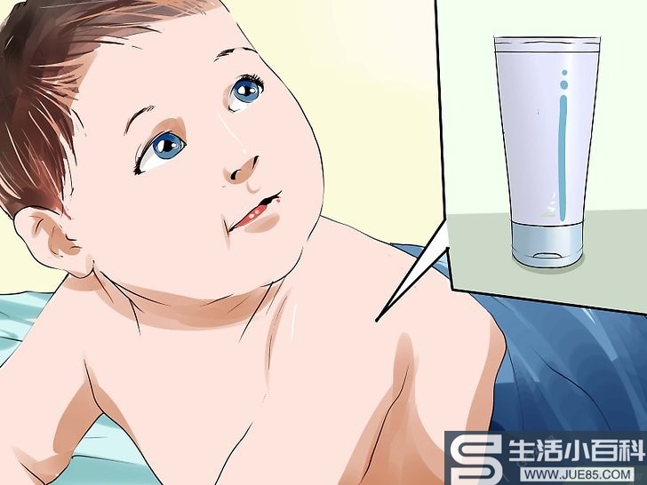 如何治疗婴儿湿疹: 13 步骤