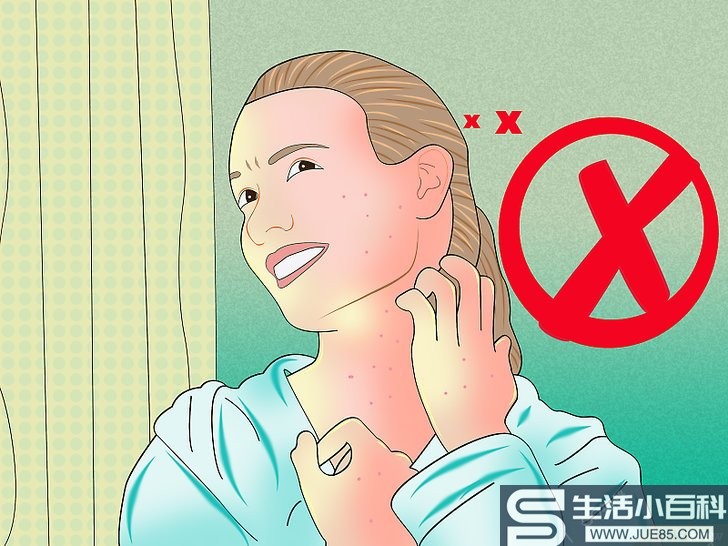 如何缓解水痘引起的瘙痒: 11 步骤