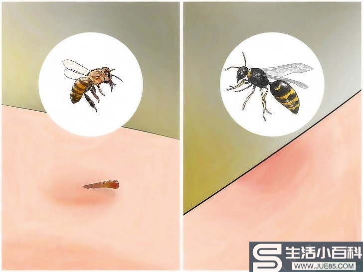 如何识别昆虫叮咬: 15 步骤