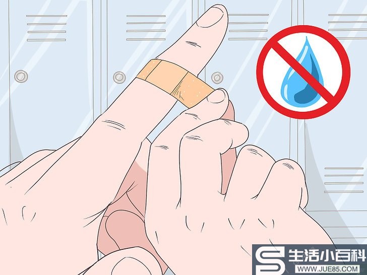 如何处理割破的手指: 11 步骤