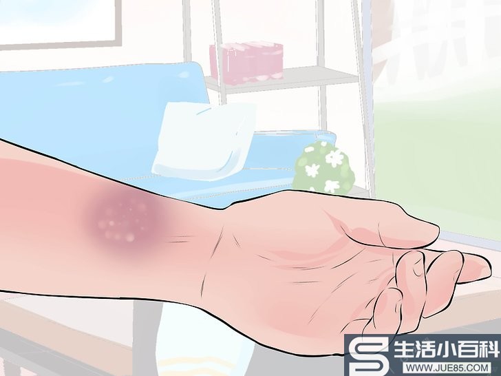如何辨别手腕扭伤和手腕骨折