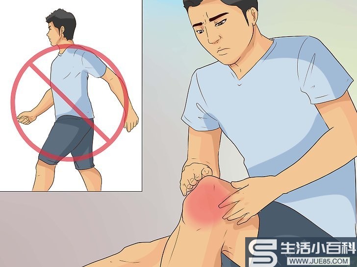 如何治疗膝盖扭伤: 13 步骤
