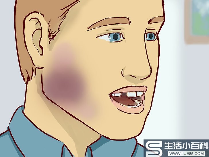 如何治疗嘴角伤口（包含图片）