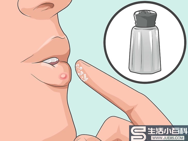 5种方法来自然地治愈唇疱疹