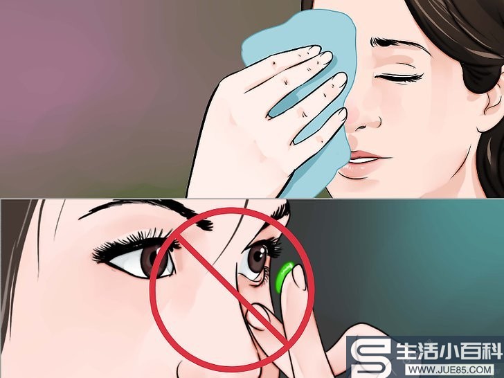 5种方法来用自然方法治疗眼部感染