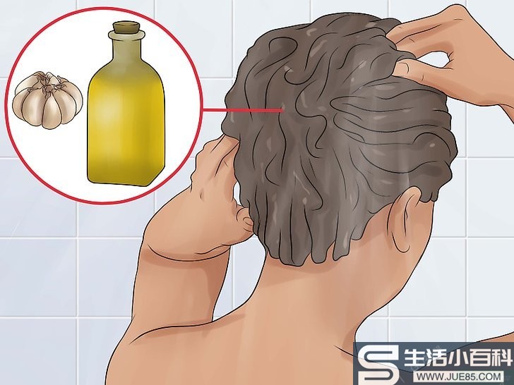 4种方法来用大蒜治疗脱发