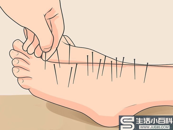 如何治疗足部神经病变: 15 步骤