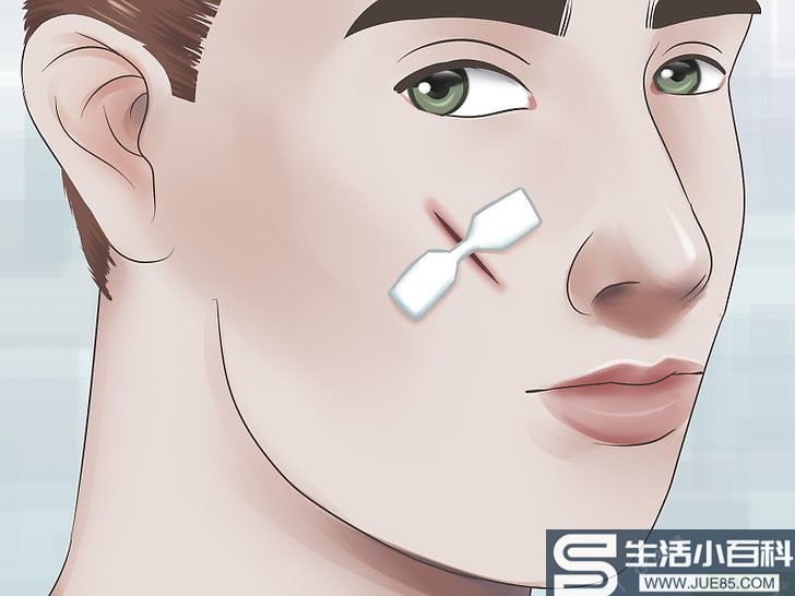 如何去除脸上的伤口（包含图片）