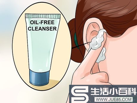 3种方法来处理耳朵里的痘痘