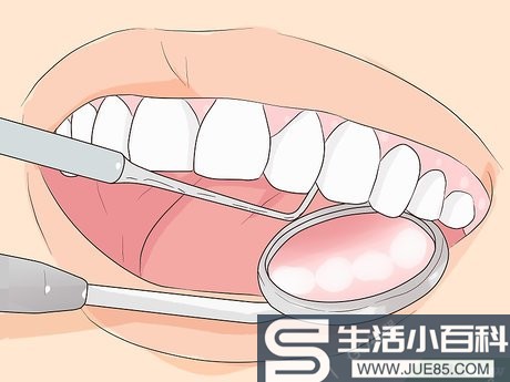 3种方法来预防牙结石