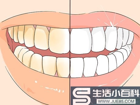 3种方法来预防牙结石