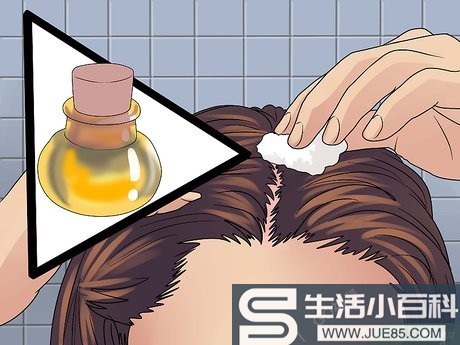 如何处理头皮晒伤: 12 步骤