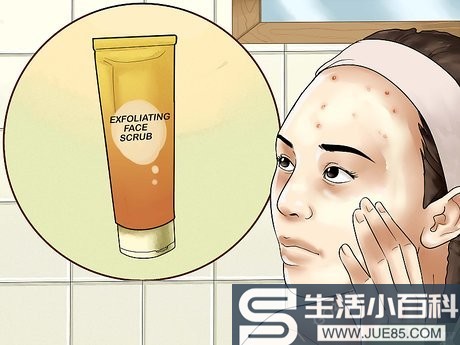 4种方法来摆脱额头上的粉刺