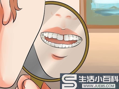 如何去除牙缝: 14 步骤