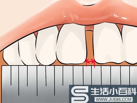 如何去除牙缝: 14 步骤