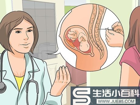 如何避免剖腹产: 13 步骤