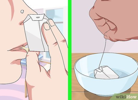 3种方法来消除打鼻洞引起的肿块